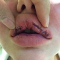 Thmubnail